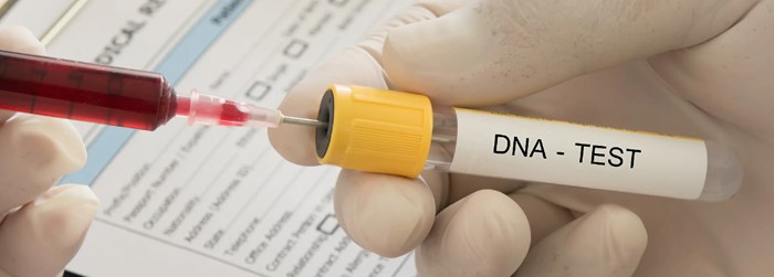 تولید کیت استخراج DNA جنین از خون مادر در کشور