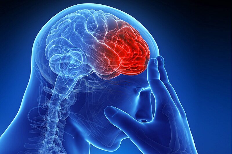 شیوع سکته مغزی بیش از بسیاری بیماریها شیوع سکته مغزی بیش از بسیاری بیماریها