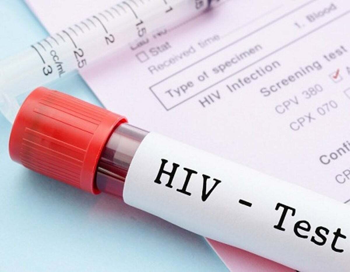 افشای اطلاعات محرمانه بیماران HIV در آزمایشگاه‌های خصوصی | در مراکز دولتی با نام مستعار آزمایش بدهید