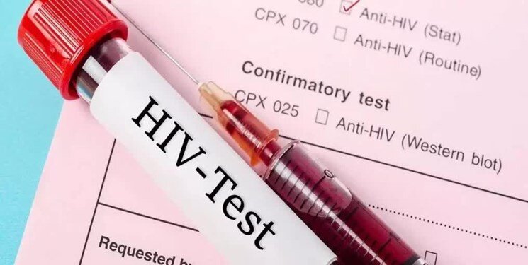 تعداد بیماران مبتلا به ایدز در کشور اعلام شد ؛ تفاوت قابل توجه تعداد مردان و زنان مبتلا به HIV (اچ‌آی‌وی)