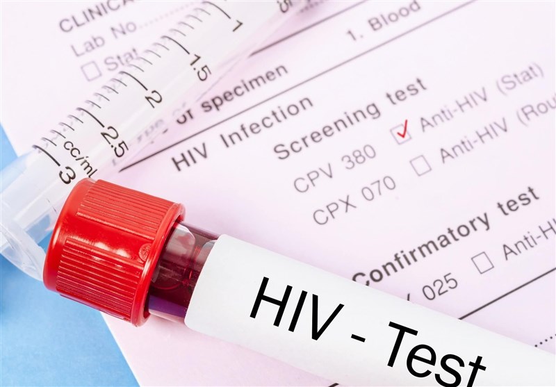 تغییر الگوی انتقال ایدز / HIV از چه راه‌هایی منتقل نمی‌شود؟