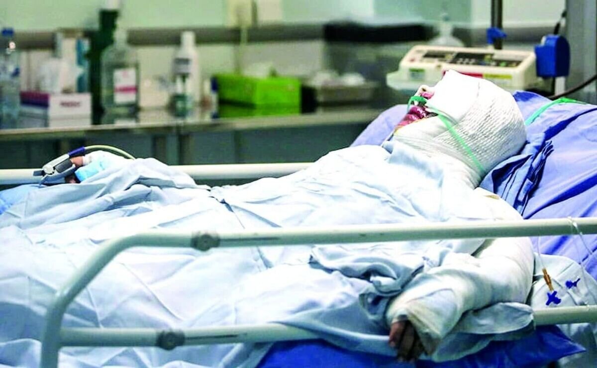 ۶۰ سال است که یک بیمارستانی سوختگی جدید بهره برداری نشده | به بسیاری از بیماران سوختگی، شغل نمی دهند