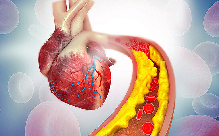 کاهش کاسترول با این چهار روش