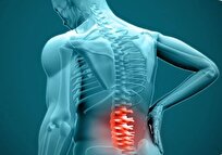 استرس مداوم عامل تشدید علائم دیسک کمر است