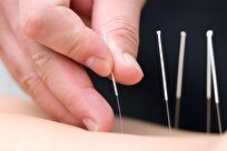 طب چینی مجموعه‌ای کامل از خدمات پیشگیری، درمان و توانبخشی