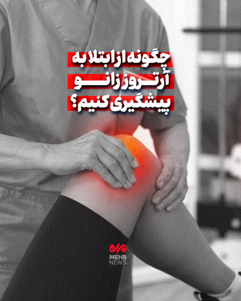 آرتروز زانو