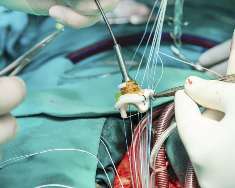 بازار جهانی TAVR