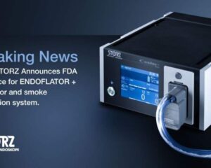 ENDOFLATOR کارل اشتورز